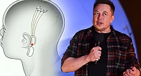 Compania Neuralink a miliardarului Elon Musk testează un nano-chip implantabil care să conecteze creierul la dispozitive informatice, la Internet și la Inteligența Artificială