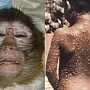 MONKEYPOX - Vărsatul de maimuță, boala misterioasă care lovește homosexualii din întreaga lume. Este la fel de mortală ca virusul Wuhan, susțin autoritățile din Marea Britanie care au lansat o ALERTĂ MEDICALĂ